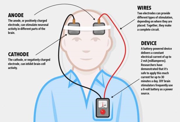 transcranial direct current stimulation_02